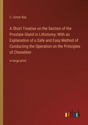 bokomslag A Short Treatise on the Section of the Prostate Gland in Lithotomy; With an Explanation of a Safe and Easy Method of Conducting the Operation on the Principles of Cheselden