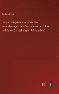 Die pathologisch-anatomischen Vernderungen des Duodenums bei Ulkus und deren Darstellung im Rntgenbild 1