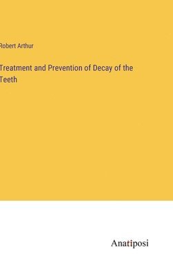 Treatment and Prevention of Decay of the Teeth 1
