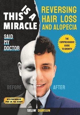 bokomslag This Is a Miracle Said My Doctor: Reversing Hair Loss and Alopecia