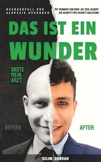 bokomslag Das Ist Ein Wunder Sagte Mein Arzt: Haarverlust Und Alopezie Umkehren