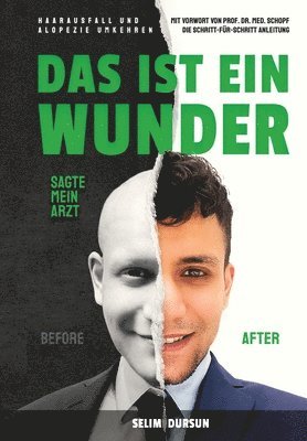 bokomslag Das Ist Ein Wunder Sagte Mein Arzt: Haarverlust Und Alopezie Umkehren