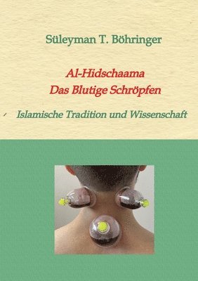 bokomslag Al-Hidschaama Das Blutige Schröpfen: Islamische Tradition und Wissenschaft