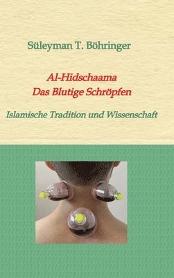 Al-Hidschaama Das Blutige Schröpfen: Islamische Tradition und Wissenschaft 1