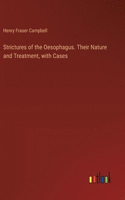 Strictures of the Oesophagus. Their Nature and Treatment, with Cases 1