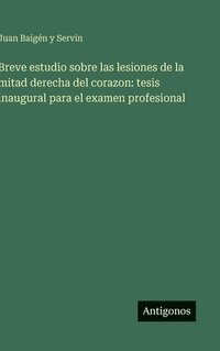 bokomslag Breve estudio sobre las lesiones de la mitad derecha del corazon