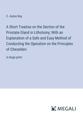 bokomslag A Short Treatise on the Section of the Prostate Gland in Lithotomy; With an Explanation of a Safe and Easy Method of Conducting the Operation on the Principles of Cheselden