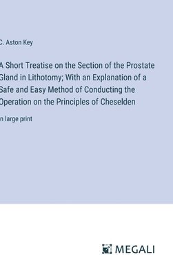 bokomslag A Short Treatise on the Section of the Prostate Gland in Lithotomy; With an Explanation of a Safe and Easy Method of Conducting the Operation on the Principles of Cheselden