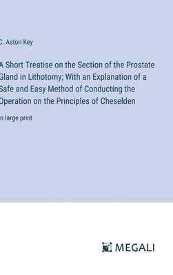 A Short Treatise on the Section of the Prostate Gland in Lithotomy; With an Explanation of a Safe and Easy Method of Conducting the Operation on the Principles of Cheselden 1