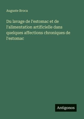 Auguste Broca - Du lavage de l'estomac et de l'alimentation artificielle dans quelques affections chroniques de l'estomac, Häftad