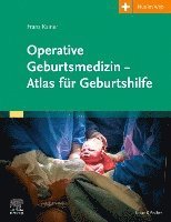 Operative Geburtsmedizin - Atlas für Geburtshilfe 1