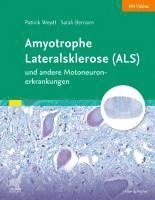 Amyotrophe Lateralsklerose (ALS) und andere Motoneuronerkrankungen 1