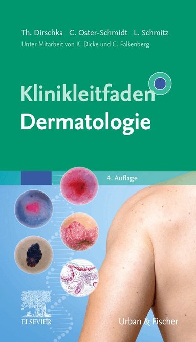 Thomas Dirschka, Claus Oster-Schmidt, Lutz Schmitz - Klinikleitfaden Dermatologie, Inbunden