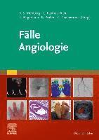 Fälle Angiologie 1