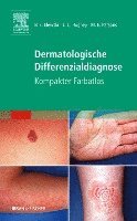 bokomslag Dermatologische Differenzialdiagnose