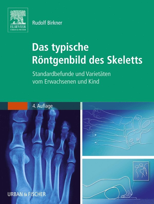Rudolf Birkner - Das typische R�ntgenbild des Skeletts, Häftad