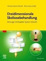 Dreidimensionale Skoliosebehandlung 1