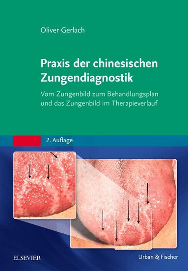 Oliver Gerlach - Praxis der chinesischen Zungendiagnostik, Inbunden
