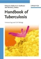 bokomslag Handbook of Tuberculosis