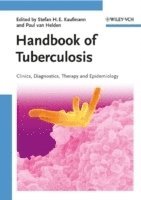 bokomslag Handbook of Tuberculosis