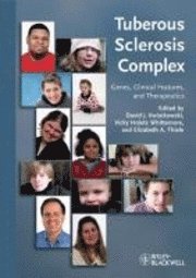 bokomslag Tuberous Sclerosis Complex