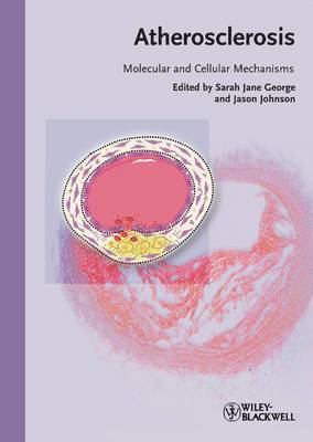 bokomslag Atherosclerosis