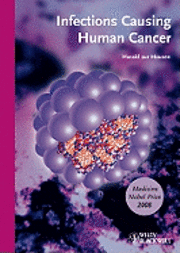Infections Causing Human Cancer 1
