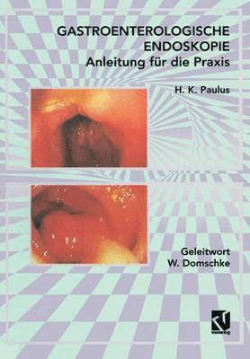 Gastroenterologische Endoskopie Anleitung fr die Praxis 1