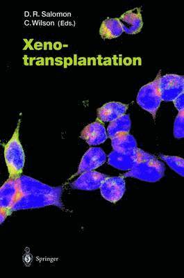 Daniel R. Salomon, Carolyn Wilson, Carolyn Wilson, Daniel R. Salomon - Xenotransplantation, Inbunden