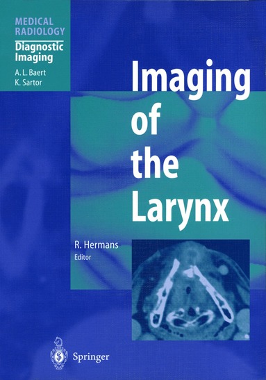 Robert Hermans - Imaging of the Larynx, Häftad