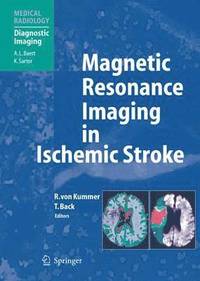 bokomslag Magnetic Resonance Imaging in Ischemic Stroke