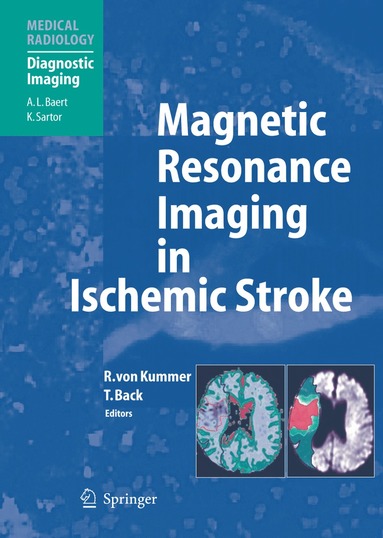 bokomslag Magnetic Resonance Imaging in Ischemic Stroke