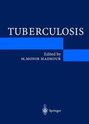 bokomslag Tuberculosis