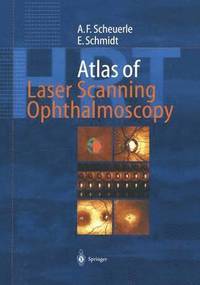 bokomslag Atlas of Laser Scanning Ophthalmoscopy