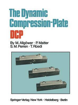 bokomslag The Dynamic Compression Plate DCP