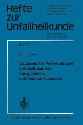 Hautersatz bei Verbrennungen mit Spalthautnetztransplantaten und Xenotransplantaten 1