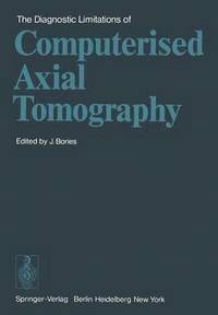 bokomslag The Diagnostic Limitations of Computerised Axial Tomography