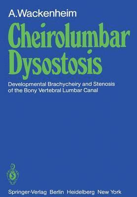 Cheirolumbar Dysostosis 1
