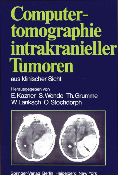 E. Kazner, S. Wende, T. Grumme, W. Lanksch, O. Stochdorph - Computertomographie intrakranieller Tumoren aus klinischer Sicht, Häftad