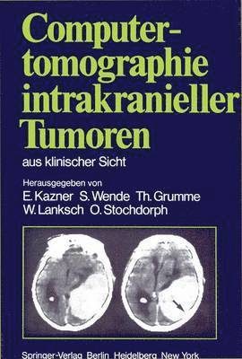 Computertomographie intrakranieller Tumoren aus klinischer Sicht 1