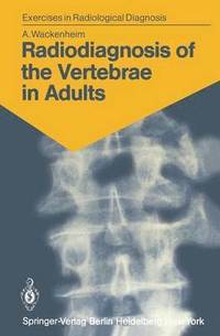 bokomslag Radiodiagnosis of the Vertebrae in Adults