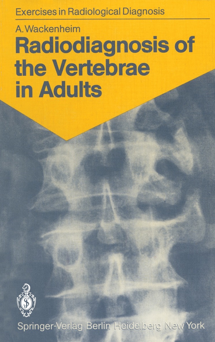 Radiodiagnosis of the Vertebrae in Adults 1