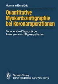 bokomslag Quantitative Myokardszintigraphie bei Koronaroperationen