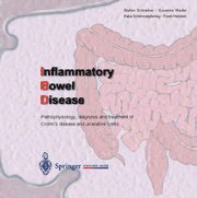 bokomslag Inflammatory Bowel Disease: Pathophysiology, Diagnosis and Treatment of Crohn's Disease and Ulcerative Colitis