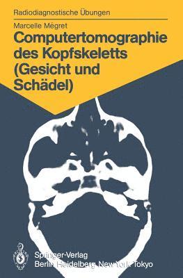 Computertomographie des Kopfskeletts (Gesicht und Schdel) 1