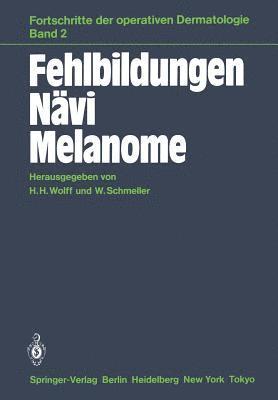 Fehlbildungen Nvi Melanome 1