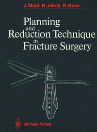 bokomslag Planning and Reduction Technique in Fracture Surgery