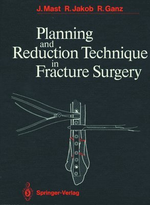 Planning and Reduction Technique in Fracture Surgery 1