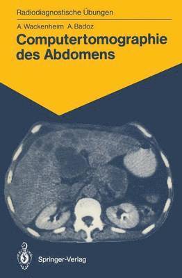 bokomslag Computertomographie des Abdomens