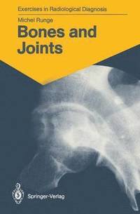 bokomslag Bones and Joints